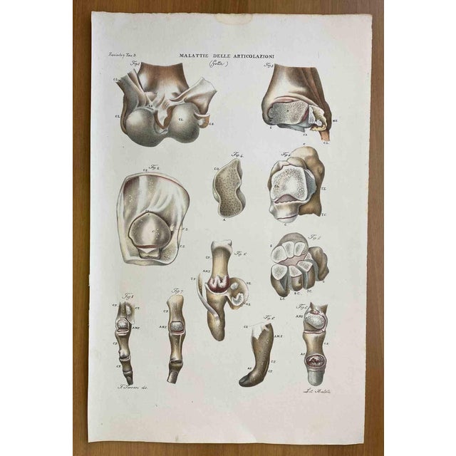 Ottavio Muzzi, Joint Diseases, Lithograph, 1843 For Sale