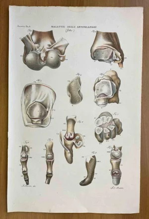 Ottavio Muzzi, Joint Diseases, Lithograph, 1843