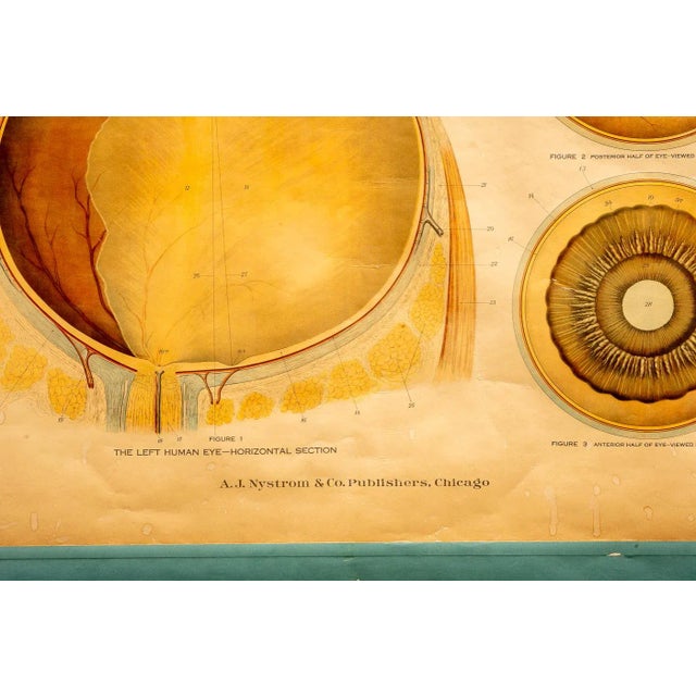 1910s Circa 1918 American Frohse Anatomical Chart For Sale - Image 5 of 7