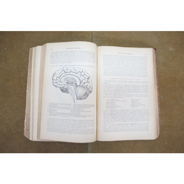 Antique 1878 Grays Anatomy Descriptive Surgical Medical Book Henry C Lea Leather For Sale - Image 14 of 16