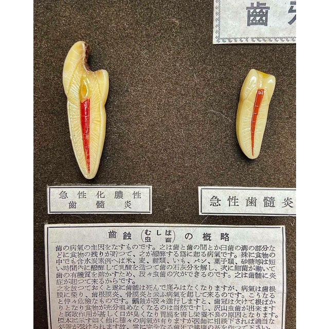 Black Japanese Dental Teaching Display with Anatomical Models, 1920s For Sale - Image 8 of 18