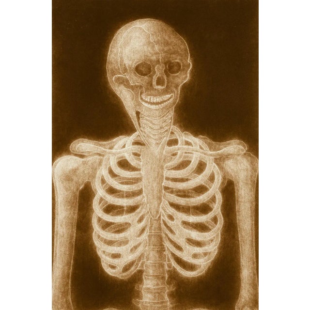 Alain Gerard Clement Silver Gelatin Photogenic Image Human Skeleton For Sale - Image 10 of 11