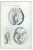 Ottavio Muzzi, Brain Diseases, Lithograph, 1843 For Sale