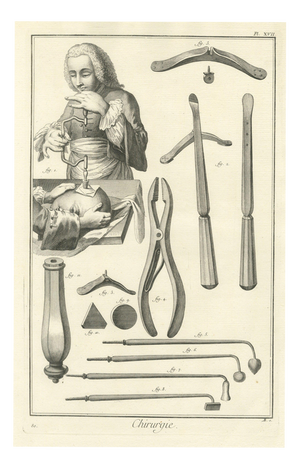 Antonio Baratti, Trepanning the Skull and Cautery Irons, Diderot Chirurgie Plate Xvii, 1772, Engraving