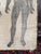 Sand 1800s Limestone Medical Lithography Plate For Sale - Image 8 of 15