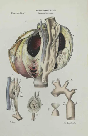 Ottavio Muzzi, Liver Disease, Lithograph, 1843