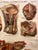 Early 20th Century Genito-Urinary Anatomical Chart, Paper on Canvas, 1922 For Sale - Image 5 of 16