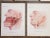 Antique Surgical Lithographs-Anatomy-Head/Neck Surgery-Set of 5 For Sale - Image 4 of 6