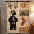 German, educational, anatomical, roll-up chart depicting glands of the human endocrine system from the Deutsches Hygiene...