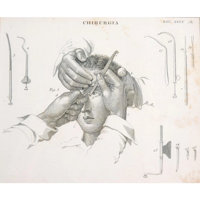 Antique print by c. Pastore, with illustrations of ophthalmic surgery origin italy period first half of the nineteenth...