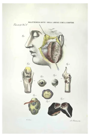 Ottavio Muzzi, Diseases of the Eyes, Larynx and Parotis, Lithograph, 1843