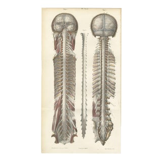 Brain and Spinal Cord in Situ from Hirschfeld, 1866 For Sale