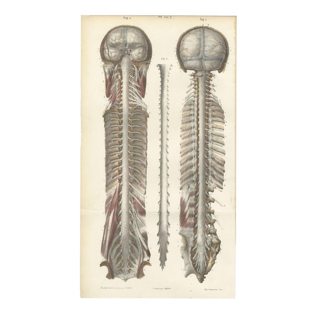 Brain and Spinal Cord in Situ from Hirschfeld, 1866 For Sale