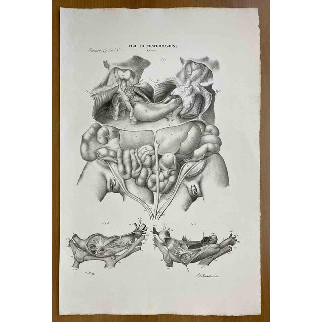 Ottavio Muzzi, Conformation Defects, Lithograph, 1843 For Sale