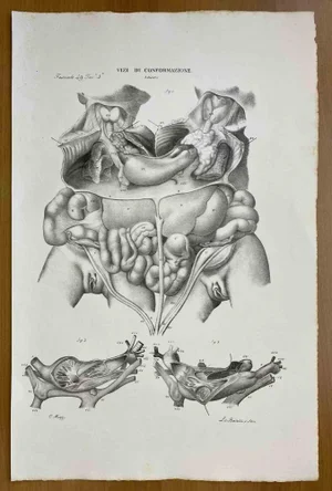 Ottavio Muzzi, Conformation Defects, Lithograph, 1843