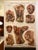 Genito-Urinary Anatomical Chart by Fritz Frohse. Dated 1922. Paper mounted on canvas. Shows wear but still presents very...