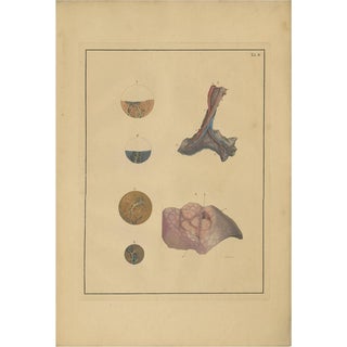F.D. Reisseisen, Medical Print of Lungs, 1822, Print For Sale