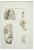 Ottavio Muzzi, Brain Diseases, Lithograph, 1843 For Sale