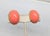 1970s or 1980s oval goldtone cabochon faux-coral clip earrings. Marked "ALEXIS © KIRK" in a cartouche on the backs....