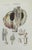 Liver Desease is a lithograph hand colored by Ottavio Muzzi for the edition of Antoine Chazal, Human Deseases, Printers...