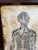 Mid 19th Century 1800s Limestone Medical Lithography Plate For Sale - Image 5 of 15
