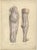 Kuhff, Illustrations of Human Legs, 1879, Prints, Set of 4 For Sale - Image 3 of 6