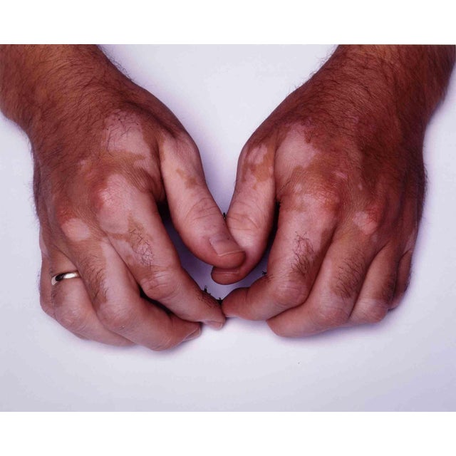 Nedko Solakov, Vitiligo People # 4, 2001, Mixed Media For Sale