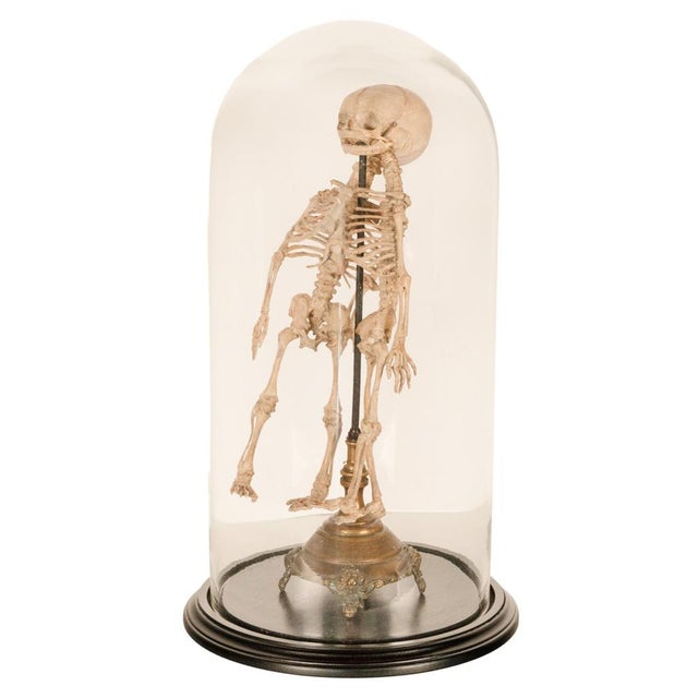 Antique 19thC Anatomical Conjoined Syncephalus Twins Skeleton Medical Model 1860 For Sale - Image 4 of 17