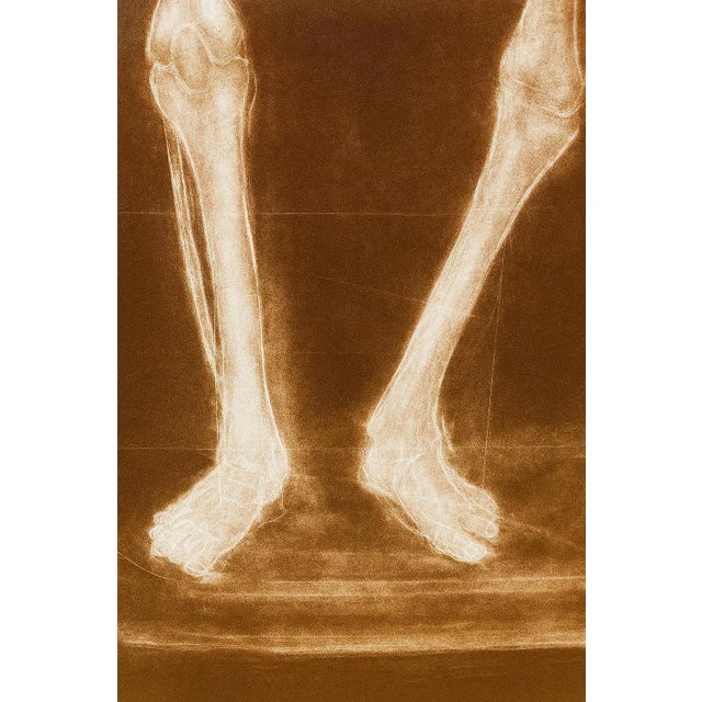 Alain Gerard Clement Silver Gelatin Photogenic Image Human Skeleton For Sale In Palm Springs - Image 6 of 11