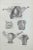 Uterus Diseases is a lithograph hand colored by Ottavio Muzzi for the edition of Antoine Chazal, Human Anatomy, Printers...