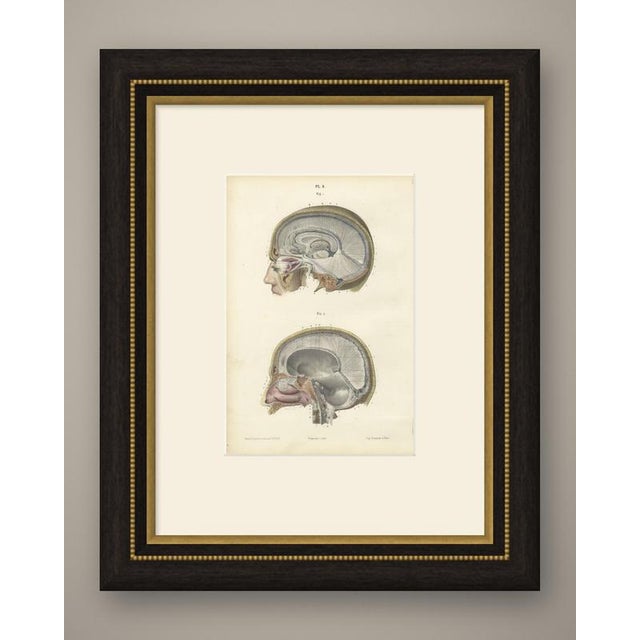 This antique anatomy print of median sagittal sections of the head is an original 1866 hand coloured lithograph from...