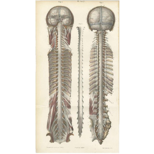 Gold Brain and Spinal Cord in Situ from Hirschfeld, 1866 For Sale - Image 8 of 8
