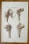 Bone Diseases is a lithograph hand colored by Ottavio Muzzi for the edition of Antoine Chazal, Human Anatomy, Printers...