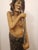 This sculpture is a profound realisation of the "Sick Man," one of the pivotal Four Sights from the Buddhacharita, the...
