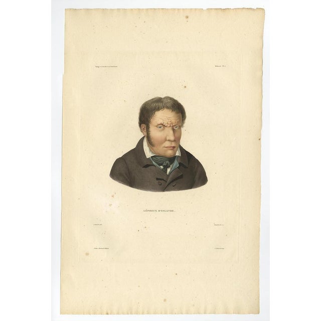 After Gaimard, Iceland, Lepers, 1842, Prints, Set of 3 For Sale - Image 3 of 10