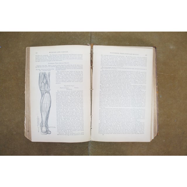 Antique 1878 Grays Anatomy Descriptive Surgical Medical Book Henry C Lea Leather For Sale - Image 15 of 16