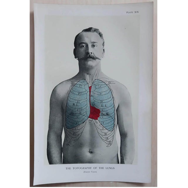 Vintage Medical Prints, 1900, Set of 8, Paper, in Very Good conditions. Designed 1890 to 1919