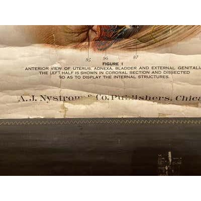 Textile Genito-Urinary Anatomical Chart, Paper on Canvas, 1922 For Sale - Image 7 of 16