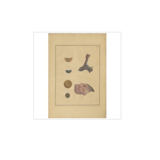 F.D. Reisseisen, Medical Print of Lungs, 1822, Print For Sale - Image 4 of 5