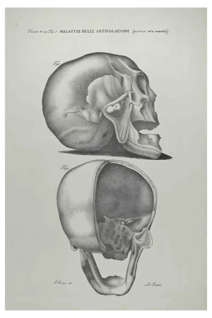 Ottavio Muzzi, Joint Diseases, Lithograph, 1843