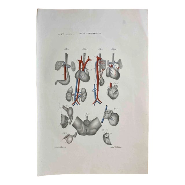 Ottavio Muzzi, Conformation Defects, Lithograph, 1843 For Sale