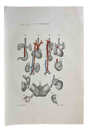 Ottavio Muzzi, Conformation Defects, Lithograph, 1843