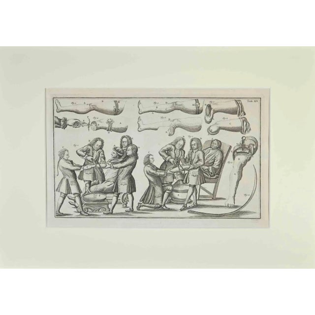 Surgical treatments is part of the suite realized by lorenz heister in the series of institutiones chirurgicae, amsterdam,...