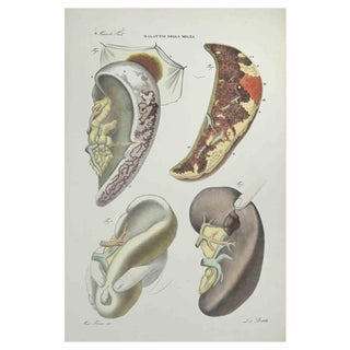 Ottavio Muzzi, Liver Diseases, Lithograph, 1843 For Sale