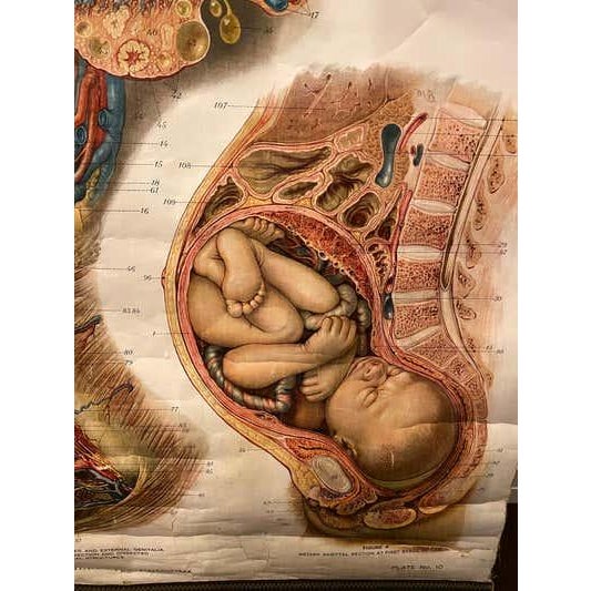 Genito-Urinary Anatomical Chart, Paper on Canvas, 1922 For Sale - Image 15 of 16
