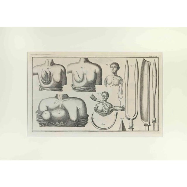 Surgical instruments is part of the suite realized by lorenz heister in the series of institutiones chirurgicae,...