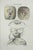 Brain Diseases is a lithograph hand colored by Ottavio Muzzi for the edition of Antoine Chazal, Human Anatomy, Printers...