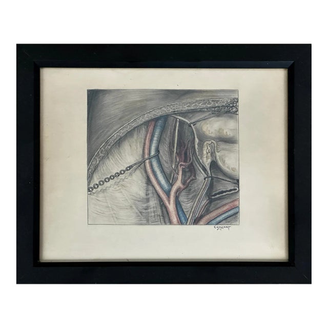 Antique 19th Century Surgical Mixed Media Drawing, Signed For Sale