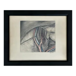 Antique 19th Century Surgical Mixed Media Drawing, Signed
