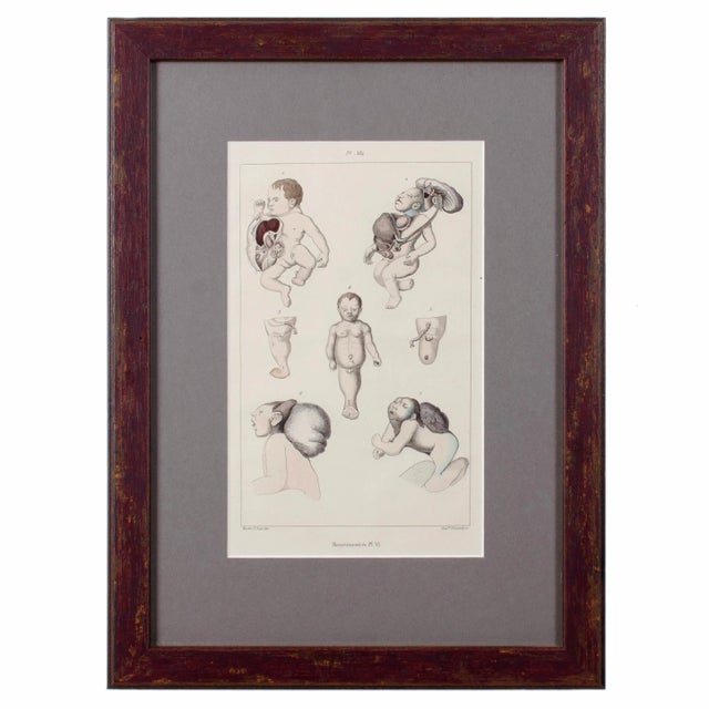 Gray Monstruosites, Engravings From Isidore Geoffrey Sainte-Hilaire, Paris C. 1832 - Set of 4 For Sale - Image 8 of 13